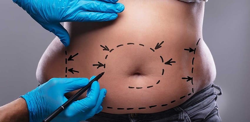 HD Liposakcija Turkijoje