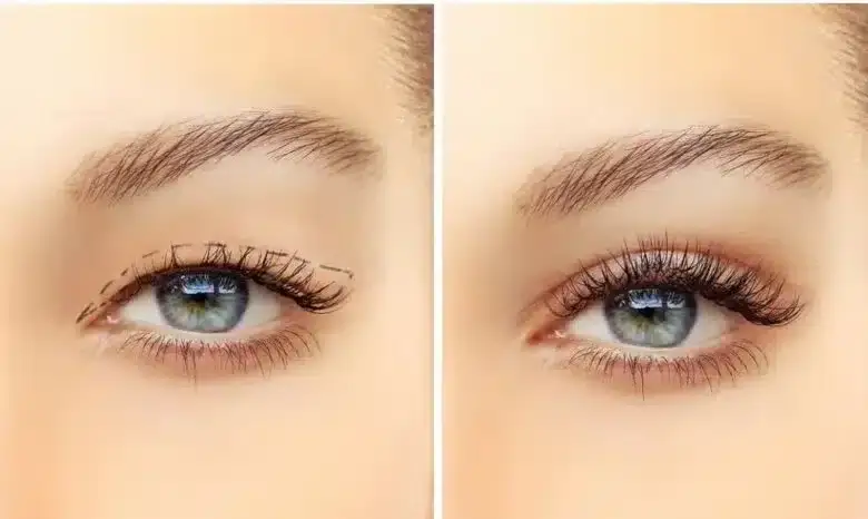 Antakių pakėlimo operacija : jaunatviška ir gaivi išraiška Turkijoje