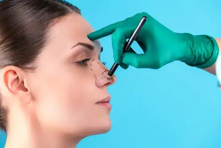 Etninė Rinoplastika