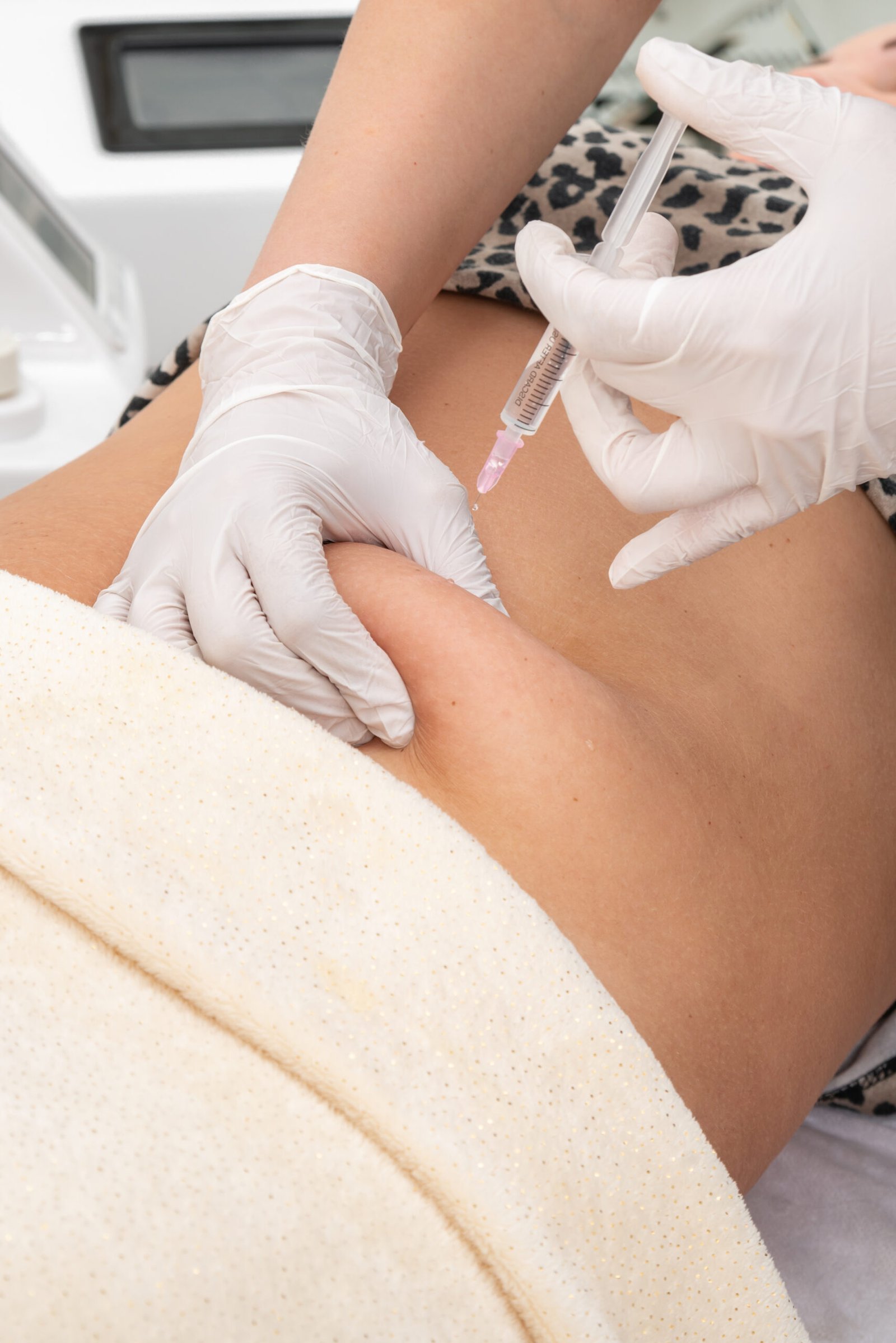 Injekcinės lipolizės procedūra pilvo riebalų skaidymui Stambulo klinikoje