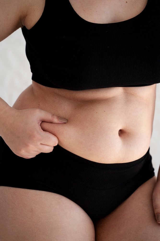 Plastikos chirurgo konsultacija prieš liposukciją Cayra klinikoje