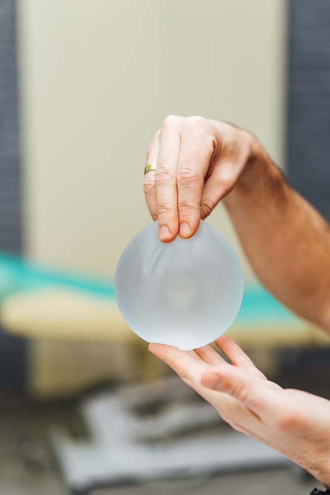 Plastikos chirurgo konsultacija: kuris krūtų didinimo metodas tinka jums