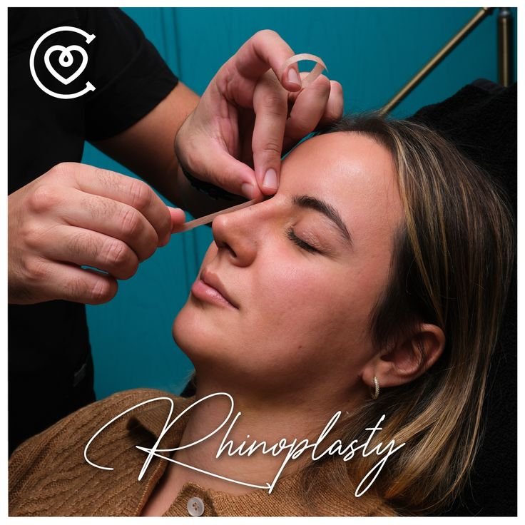 Nosies operacijos ir rinoplastika Turkijoje Cayra Clinic klinikoje Antalijoje ir Stambule