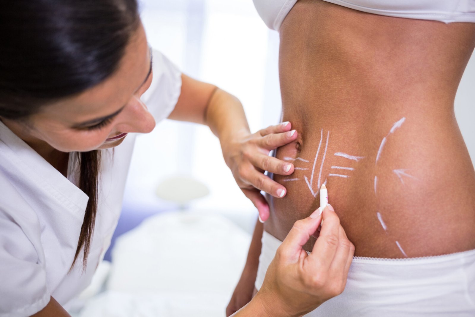 Pilvo Raumenų Išryškinimas (Abdominal Etching) Ir 360 Liposukcija