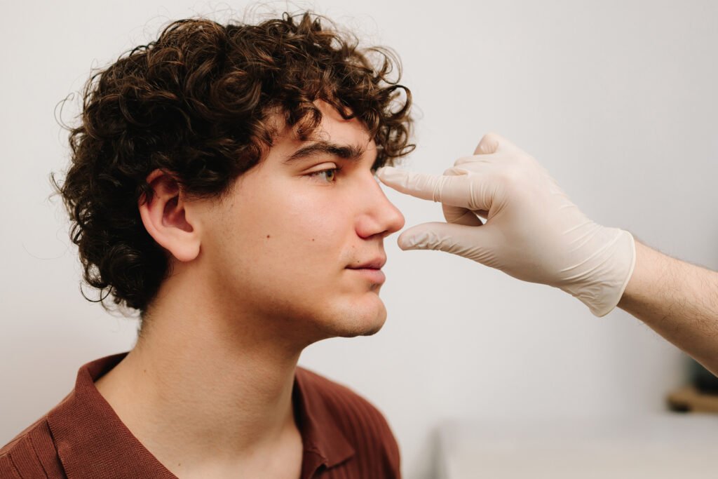 Risultati naturali di rinoplastica maschile prima e dopo in una clinica in Turchia